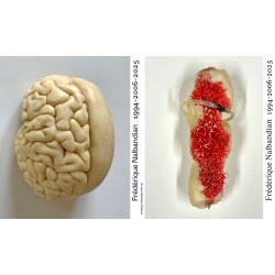 Frédérique Nalbandian 1994 2024 monographie